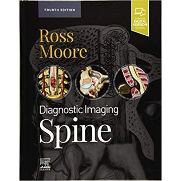 Diagnostic Imaging: Spine, 4th Edition
