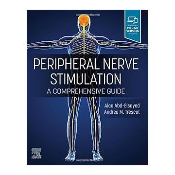 Peripheral Nerve Stimulation - A Comprehensive Guide