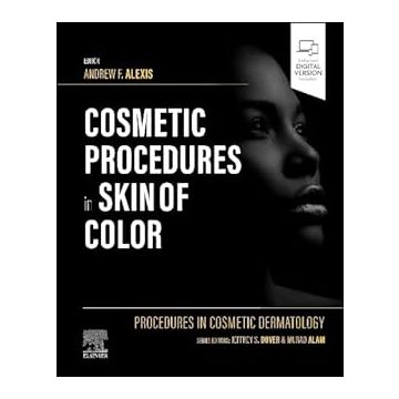 Procedures in Cosmetic Dermatology: Cosmetic Procedures in Skin of Color