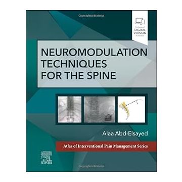 Neuromodulation Techniques for the Spine - A Volume in the Atlas of Interventional Pain Management Series