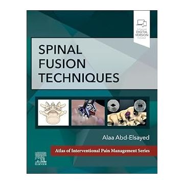 Spinal Fusion Techniques