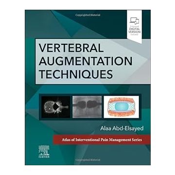 Vertebral Augmentation Techniques