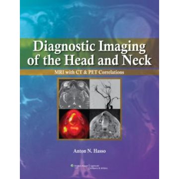 Diagnostic Imaging of the Head and Neck  Hasso Anton N.  LIPPINCOTT Williams and Wilkins  9780397515370