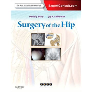 Surgery of the Hip - Expert Consult - Online and Print Berry Lieberman Elsevier Science