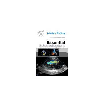 Essential Echocardiography
