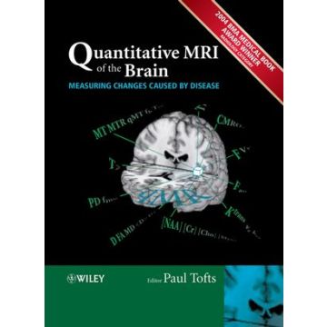 Quantitative MRI of the Brain: Measuring Changes Caused by Disease  Tofts Paul  Wiley - Blackwell  9780470014295