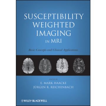 Susceptibility Weighted Imaging in MRI: Basic Concepts and Clinical Applications  Haacke E. Mark; Reichenbach Jurgen R.  Wiley - Blackwell  9780470043431