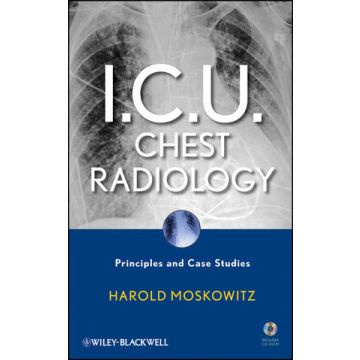 I.C.U. Chest Radiology: Principles and Case Studies  Moskowitz Harold  Wiley - Blackwell  9780470450345