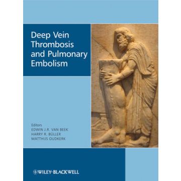 Deep Vein Thrombosis and Pulmonary Embolism  Van Beek Edwin J. R.; Büller Harry R.; Oudkerk Mathijs  Wiley - Blackwell  9780470517178
