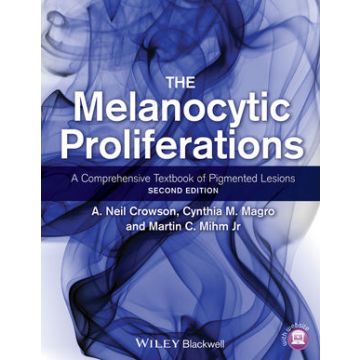 The Melanocytic Proliferations: A Comprehensive Textbook of Pigmented Lesions, 2ed.  Crowson A. Neil; Magro Cynthia M.; Mihm Martin C.  Wiley - Blackwell  9780470561553