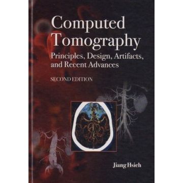Computed Tomography Principles, Design, Artifacts, and Recent Advances, 2ed.  Hsieh Jiang  Wiley - Blackwell  9780470563533