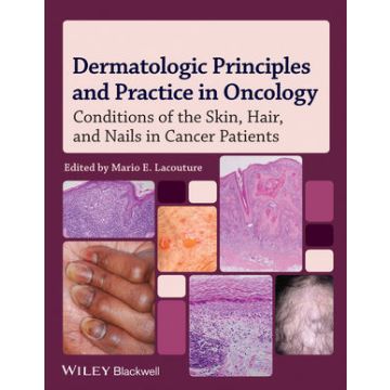Dermatologic Principles and Practice in Oncology: Conditions of the Skin, Hair, and Nails in Cancer Patients  Lacouture Mario E.  Wiley - Blackwell  9780470621882