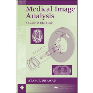 Medical Image Analysis, 2ed.  Dhawan Atam P.  Wiley - Blackwell  9780470622056