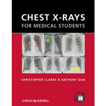 Chest X-rays for Medical Students  Clarke Christopher; Dux Anthony  Wiley - Blackwell  9780470656198
