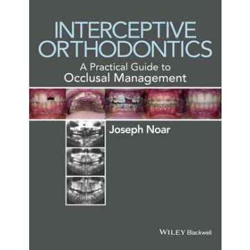 Interceptive Orthodontics: A Practical Guide to Occlusal Management  Noar Joseph  Wiley - Blackwell  9780470656211