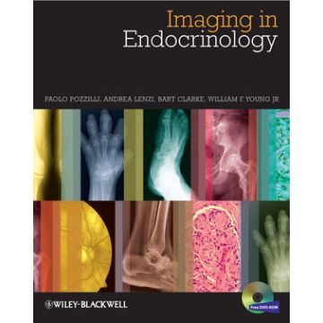 Imaging in Endocrinology  Pozzilli Paolo; Lenzi Andrea; Clarke Bart L.; Young William F.  Wiley - Blackwell  9780470656273