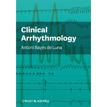 Clinical Arrhythmology  Bayes de Luna Antoni  Wiley - Blackwell  9780470656365