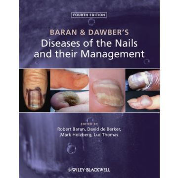 Baran and Dawber's Diseases of the Nails and their Management, 4ed.  Baran Robert; de Berker David A. R.; Holzberg Mark; Thomas Luc  Wiley - Blackwell  9780470657355