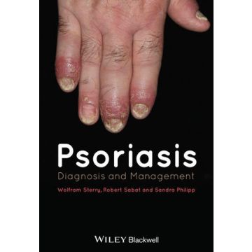 Psoriasis: Diagnosis and Management  Sterry Wolfram; Sabat Robert; Philipp Sandra  Wiley - Blackwell  9780470657362