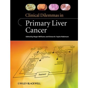 Clinical Dilemmas in Primary Liver Cancer  Williams Roger; Taylor-Robinson Simon D.  Wiley - Blackwell  9780470657973
