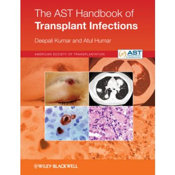 The AST Handbook of Transplant Infections  Kumar Deepali; Humar Atul  Wiley - Blackwell  9780470658277
