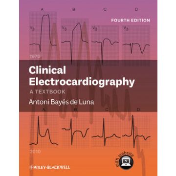Clinical Electrocardiography: A Textbook, 4ed.  Bayes de Luna Antoni  Wiley - Blackwell  9780470658598