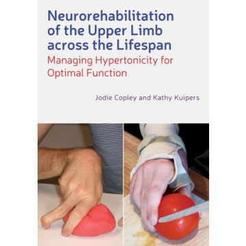 Neurorehabilitation of the Upper Limb Across the Lifespan: Managing Hypertonicity for Optimal Function  Copley Jodie; Kuipers Kathy  Wiley-Blackwell  9780470670316