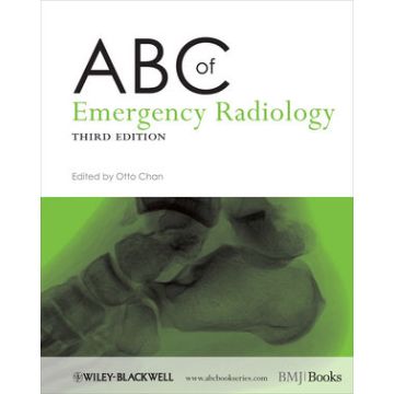 ABC of Emergency Radiology, 3ed.  Chan Otto  Wiley - Blackwell  9780470670934