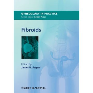 Fibroids  Segars James H.  Wiley - Blackwell  9780470670941