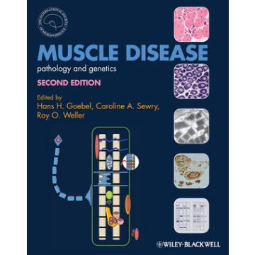 Muscle Disease: Pathology and Genetics, 2/ed.  Goebel Hans H.; Sewry Caroline A.; Weller Roy O.  Wiley-Blackwell  9780470672051
