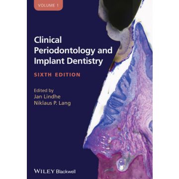 Clinical Periodontology and Implant Dentistry, 2 Volume Set, 6ed.  Lang Niklaus P.; Lindhe Jan  Wiley - Blackwell  9780470672488