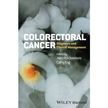 Colorectal Cancer: Diagnosis and Clinical Management  Scholefield John; Eng Cathy  Wiley - Blackwell  9780470674802