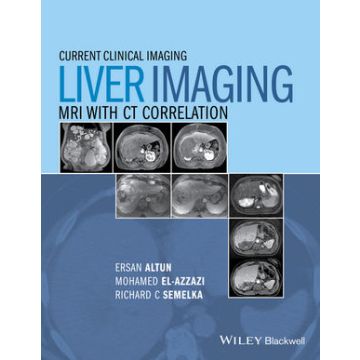 Liver Imaging: MRI with CT Correlation  Altun Ersan; El-Azzazi Mohamed; Semelka Richard C.  Wiley - Blackwell  9780470906255