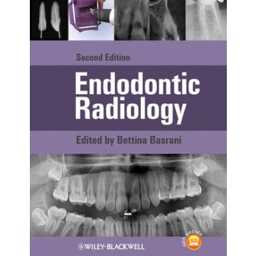 Endodontic Radiology, 2ed.  Basrani Bettina  Wiley - Blackwell  9780470958490