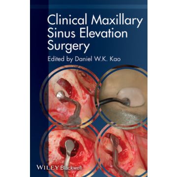 Clinical Maxillary Sinus Elevation Surgery  Kao Daniel W. K.  Wiley - Blackwell  9780470960738
