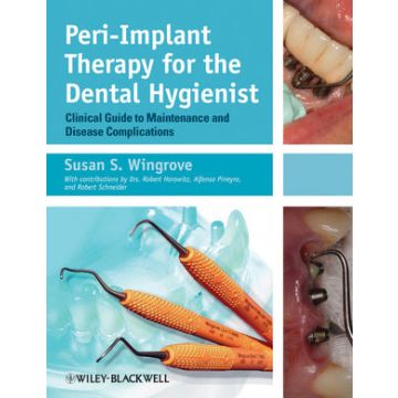 Peri-Implant Therapy for the Dental Hygienist: Clinical Guide to Maintenance and Disease Complications  Wingrove Susan S.  Wiley - Blackwell  9780470962855