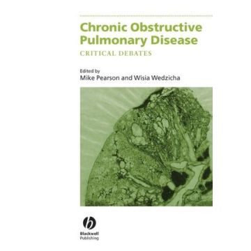 Chronic Obstructive Pulmonary Disease: Critical Debates  Pearson Michael; Wedzicha Jadwiga  Wiley - Blackwell  9780632059720