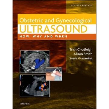 Obstetric & Gynecological Ultrasound, 4th Edition - How, Why and When    [Chudleigh - Elsevier Science]