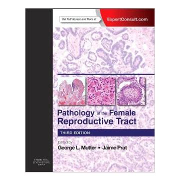 Pathology of the Female Reproductive Tract, 3rd Edition - Expert Consult: Online and Print