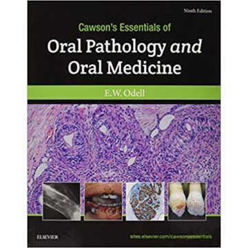 Cawson's Essentials of Oral Pathology and Oral Medicine, 9th Edition
