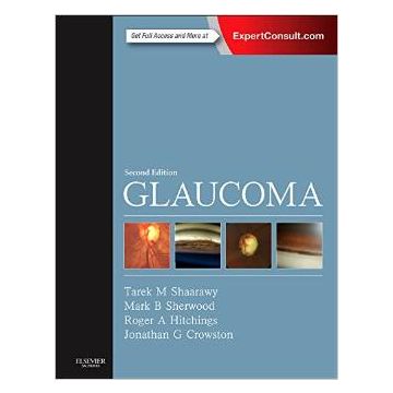 Glaucoma, 2nd Edition - 2-Volume Set  [Shaarawy Shenwood - Elsevier Science]