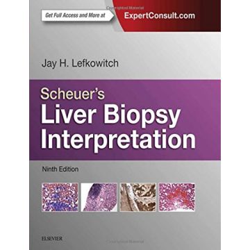 Scheuer's Liver Biopsy Interpretation, 9th Edition - Expert Consult: Online and Print  [Lefkowitch - Elsevier Science]