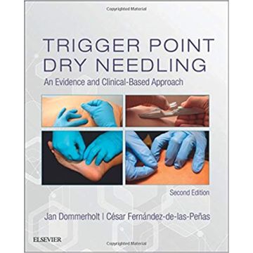 Trigger Point Dry Needling, 2nd Edition - An Evidence and Clinical-Based Approach