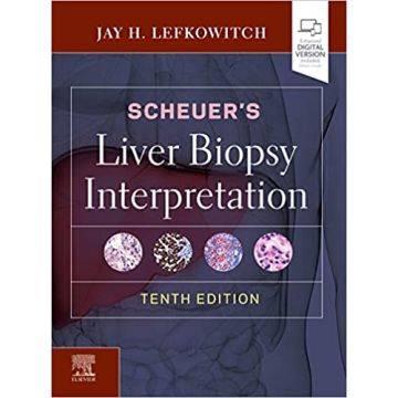 Scheuer's Liver Biopsy Interpretation, 10th Edition