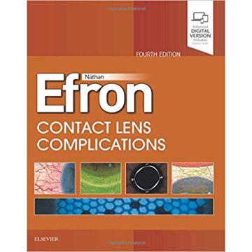 Contact Lens Complications, 4th Edition