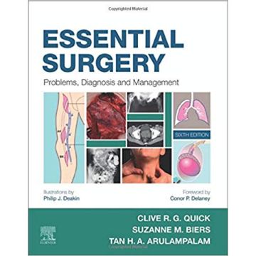 Essential Surgery, 6th Edition - Problems, Diagnosis and Management