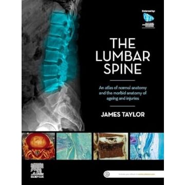 The Lumbar Spine - An Atlas of Normal Anatomy and the Morbid Anatomy of Ageing and Injury