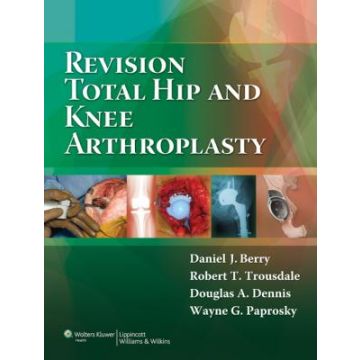Revision Total Hip and Knee Arthroplasty  Berry Daniel J.; Trousdale Robert T; Dennis Douglas A.; Paprosky Wayne G.  LIPPINCOTT Williams and Wilkins  9780781760430
