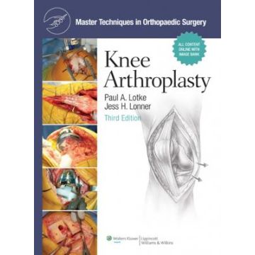 Master Techniques in Orthopaedic Surgery: Knee Arthroplasty, 3ed.  Lotke Paul A.; Lonner Jess H.  LIPPINCOTT Williams and Wilkins  9780781779227