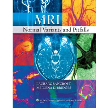 MRI Normal Variants and Pitfalls  Bancroft Laura W.; Bridges Mellena D.  LIPPINCOTT Williams and Wilkins  9780781783149